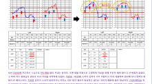 이명 난청 개선사례 2