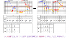 이명 난청 개선사례 3